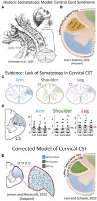 Pathophysiology and surgical decision-making in central cord syndrome and degenerative cervical myelopathy: correcting the somatotopic fallacy